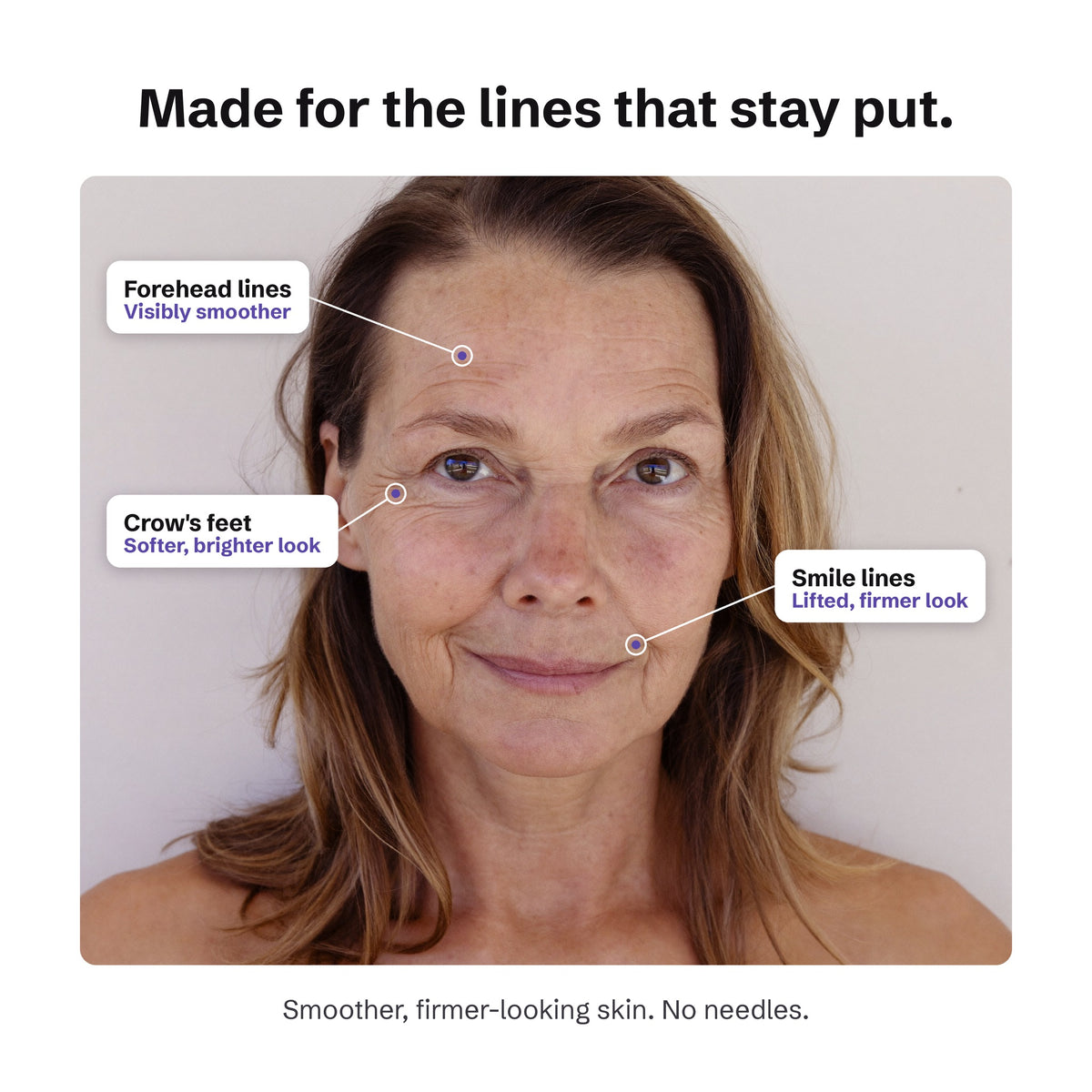 The Liquid Thread Lift